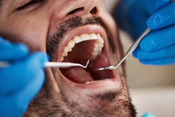 Best Emergency Dental Care  in Stonewall, MS
